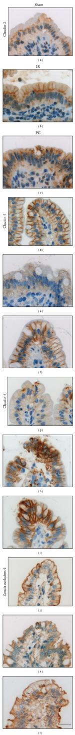 Claudin 2 Antibody in Immunohistochemistry, Immunohistochemistry (Paraffin) (IHC, IHC (P))