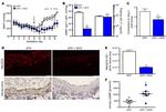 Nitrotyrosine Antibody in Immunohistochemistry (IHC)