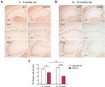 Parvalbumin Antibody in Immunohistochemistry, Immunohistochemistry (Paraffin) (IHC, IHC (P))