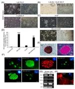 TRA-1-60 Antibody in Immunocytochemistry (ICC/IF)