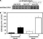 GSK3 alpha/beta Antibody in Western Blot, Immunoprecipitation (WB, IP)