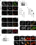 alpha Tubulin Antibody in Immunocytochemistry (ICC/IF)