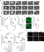 alpha Tubulin Antibody in Immunocytochemistry (ICC/IF)