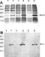 6x-His Tag Antibody in Western Blot (WB)