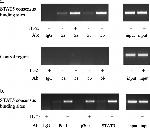 STAT5 beta Antibody in Immunoprecipitation (IP)