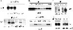 beta Amyloid Antibody in Western Blot, Immunoprecipitation (WB, IP)