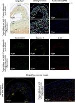 Caspase 1 Antibody in Immunohistochemistry (IHC)