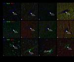 GFAP Antibody in Immunocytochemistry (ICC/IF)