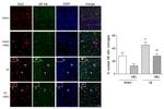 NFkB p65 Antibody in Immunocytochemistry (ICC/IF)