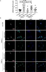 Histone H2A.X Antibody in Immunocytochemistry (ICC/IF)