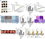 SOX2 Antibody in Immunohistochemistry (IHC)