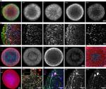 Nestin Antibody in Immunocytochemistry (ICC/IF)