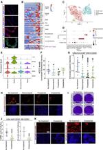 SARS/SARS-CoV-2 Nucleocapsid Antibody in Immunocytochemistry (ICC/IF)