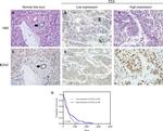 EZH2 Antibody in Immunohistochemistry (IHC)