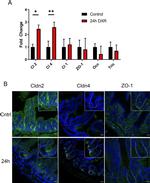 Claudin 2 Antibody in Immunohistochemistry (IHC)