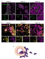 Vimentin Antibody in Immunohistochemistry (IHC)