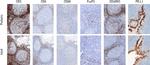 FOXP3 Antibody in Immunohistochemistry (IHC)