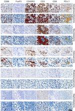 FOXP3 Antibody in Immunohistochemistry (IHC)