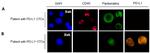 Pan Cytokeratin Antibody in Immunocytochemistry (ICC/IF)