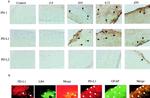 CD279 (PD-1) Antibody in Immunohistochemistry (IHC)