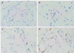 SOX2 Antibody in Immunohistochemistry (IHC)