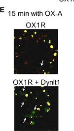 Mouse IgG (H+L) Highly Cross-Adsorbed Secondary Antibody in Immunocytochemistry (ICC/IF)