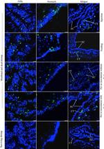 Mouse IgG (H+L) Cross-Adsorbed Secondary Antibody in Immunohistochemistry (IHC)