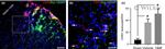 CD45 Antibody in Immunohistochemistry (IHC)