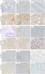 FOXP3 Antibody in Immunohistochemistry (IHC)