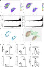 FOXP3 Antibody in Immunohistochemistry (IHC)