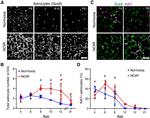 Ki-67 Antibody in Immunohistochemistry (IHC)