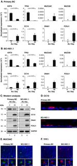 FOXJ1 Antibody in Western Blot (WB)