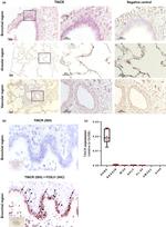 FOXJ1 Antibody in Immunohistochemistry (IHC)