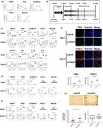 FOXJ1 Antibody in Immunocytochemistry (ICC/IF)