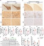 GFAP Antibody in Immunohistochemistry (IHC)