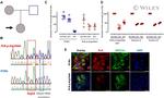 SERCA2 ATPase Antibody in Immunocytochemistry (ICC/IF)