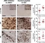 beta Amyloid Antibody in Immunohistochemistry (IHC)