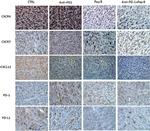 PD-1 Antibody in Immunohistochemistry (IHC)