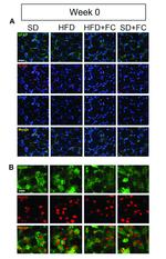 TLR4 Antibody in Immunohistochemistry (IHC)