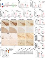 GFAP Antibody in Immunohistochemistry (IHC)