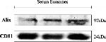 CD81 Antibody in Western Blot (WB)