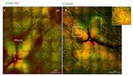 Thrombospondin 1 Antibody in Immunocytochemistry (ICC/IF)