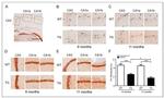 Parvalbumin Antibody in Immunohistochemistry, Immunohistochemistry (Paraffin) (IHC, IHC (P))