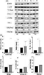 H3K4me2 Antibody in Western Blot (WB)