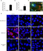 SARS/SARS-CoV-2 Nucleocapsid Antibody in Immunohistochemistry (IHC)