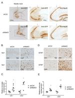 GFAP Antibody in Immunohistochemistry (IHC)