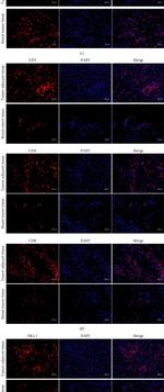 NK1.1 Antibody in Immunohistochemistry (IHC)