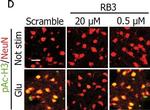 Mouse IgG (H+L) Cross-Adsorbed Secondary Antibody in Immunohistochemistry (IHC)