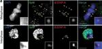 Mouse IgG (H+L) Cross-Adsorbed Secondary Antibody in Immunocytochemistry (ICC/IF)