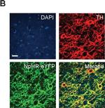 Rabbit IgG (H+L) Cross-Adsorbed Secondary Antibody in Immunohistochemistry (IHC)